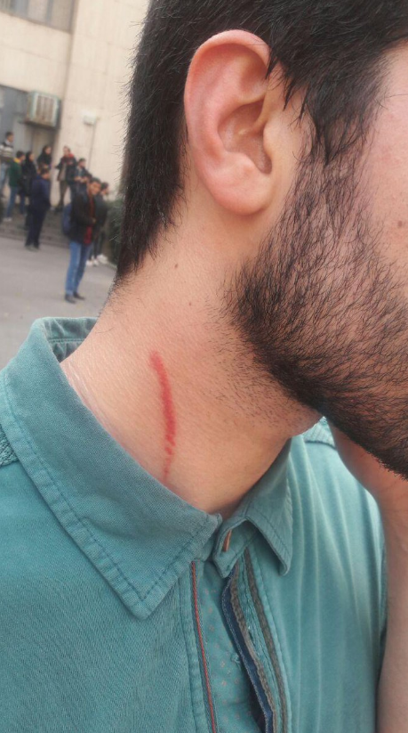 دانشجوی مصدوم حادثه تجمع دانشجویان دانشگاه امیر کبیر