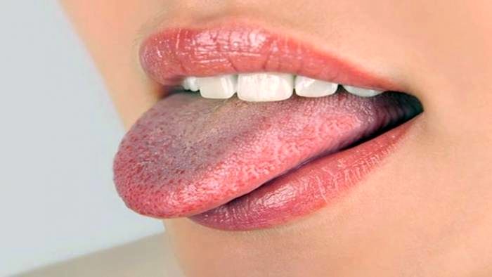 دکتر درمان زخم زبان