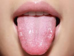 دکتر درمان زخم زبان