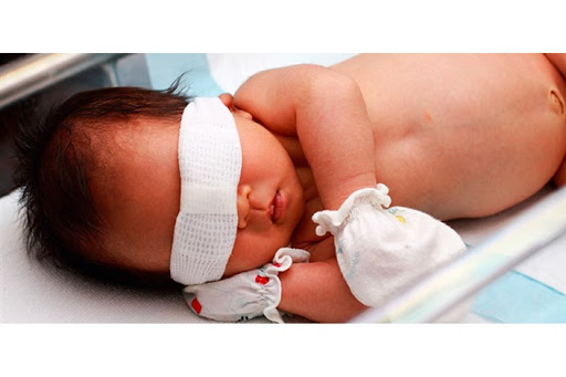 درمان زردی نوزاد با حجامت