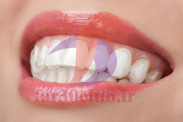 ژل سفید کننده دندان قیمت ، ژل سفید کننده دندان وایت دیزلینگ