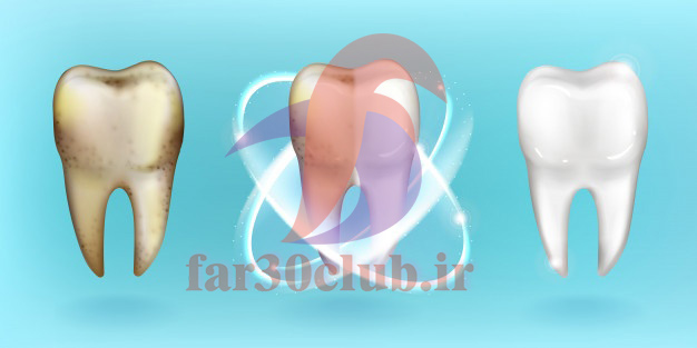 ایا ژل سفید کننده دندان ضرر دارد ، انواع ژل سفید کننده دندان