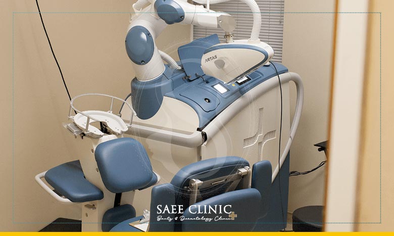 دستگاه کاشت موی آرتاس