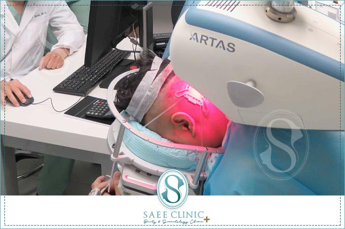 بررسی گرافت های مو توسط ربات ارتاس